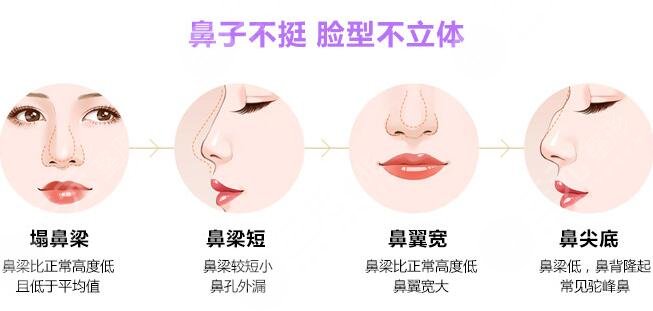 朝天短鼻整形手術(shù)