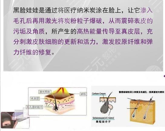 黑臉娃娃的功有哪些