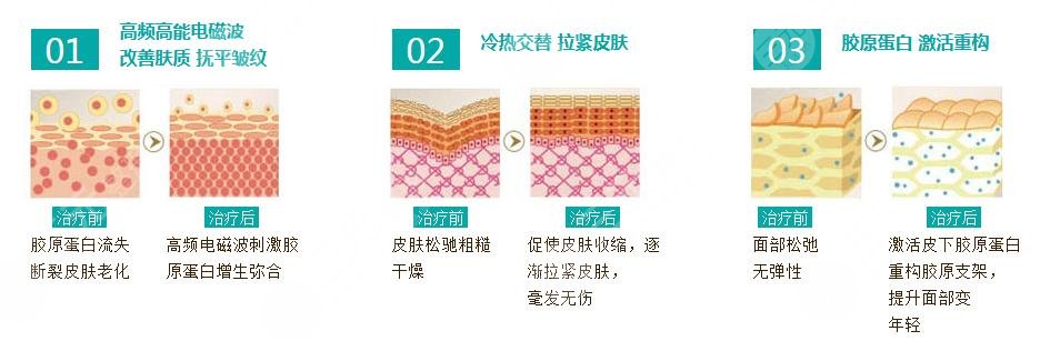 熱瑪吉成好嗎能保持多久