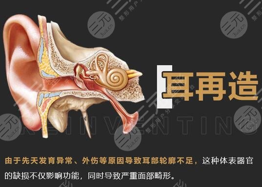 耳再造多少費用？價格參考&手術(shù)科普，耳整形避雷指南！