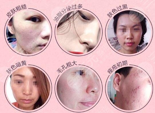 黑臉娃娃適合什么人做