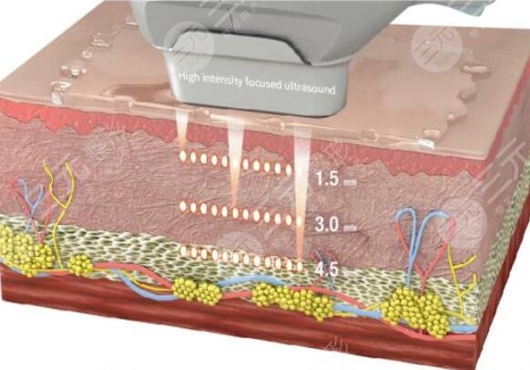 光電提拉作用的原理
