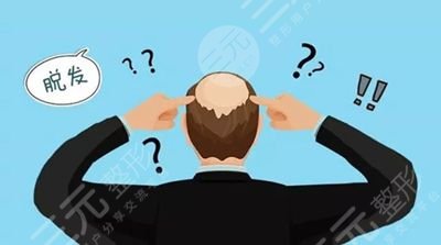 頭發(fā)種植術(shù)靠譜嗎