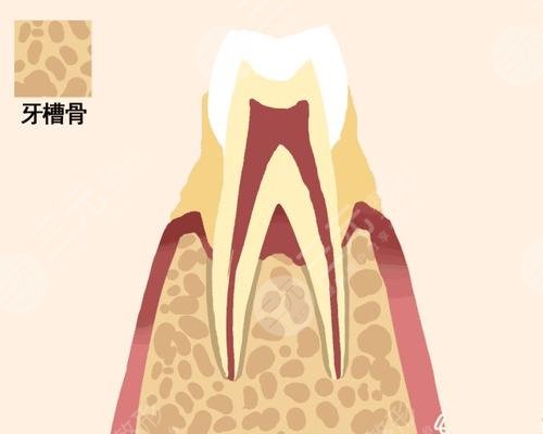 牙齒松動(dòng)是什么原因?