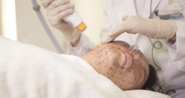 熱瑪吉除皺的果