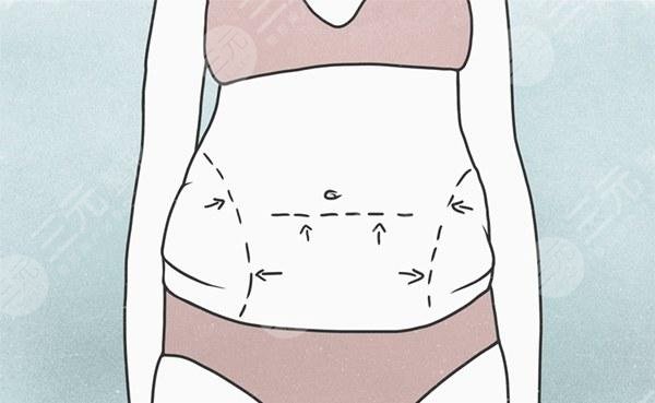 國內(nèi)吸脂好還是去韓國吸脂好