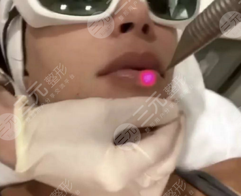 歐洲之星4d和熱瑪吉區(qū)別