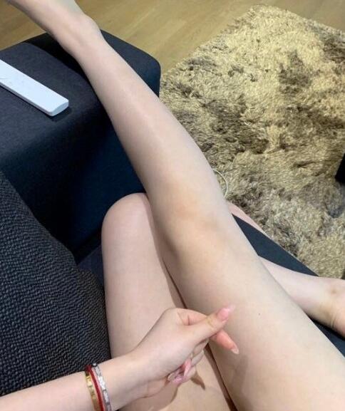 國內(nèi)吸脂醫(yī)院：北京禾美嘉大腿吸脂案例