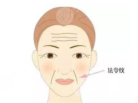 有法令紋怎么辦？去法令紋價(jià)格大概多少錢？附價(jià)格表