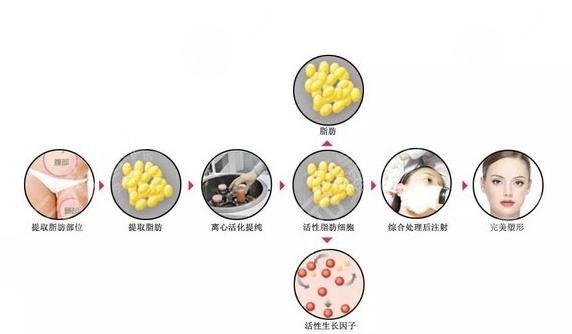 脂肪填充多久恢復(fù)