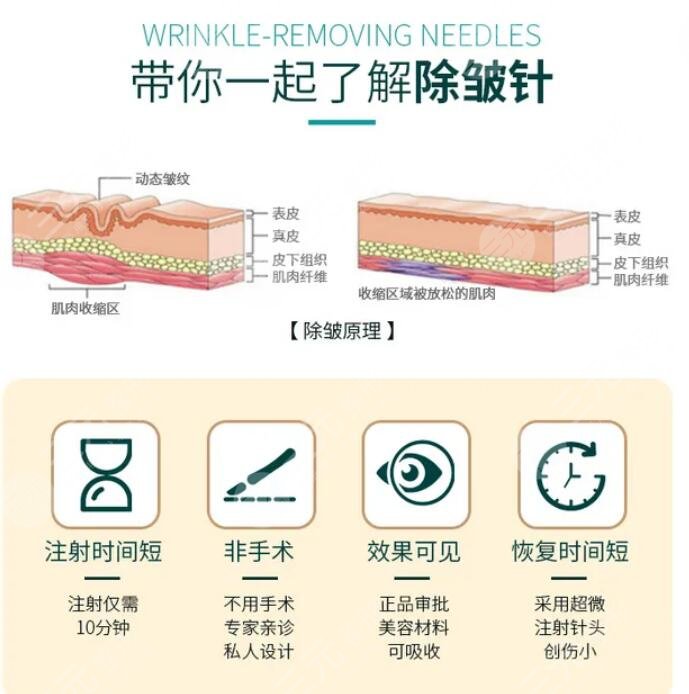 注射除皺能保持多久