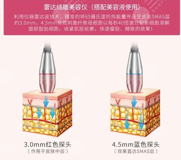 雷達(dá)提升抗皺的原理