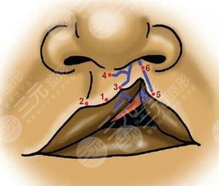 兔唇修復(fù)后的疤痕可以去掉嗎