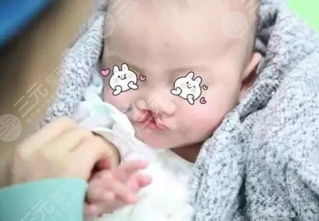 細(xì)小的線性疤痕