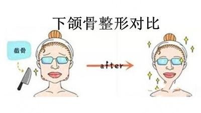 方臉和國字臉如何改良