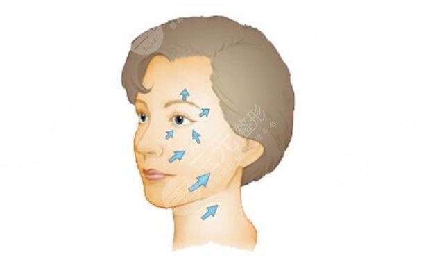 面部拉皮多久能恢復(fù)好？手術(shù)恢復(fù)時(shí)期，面部拉皮優(yōu)勢(shì)盤點(diǎn)，值得選嗎？