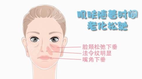 微創(chuàng)面部五層提升手術(shù)三個(gè)月后