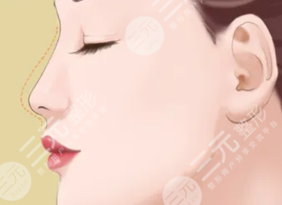 范元濤醫(yī)生整形項目科普