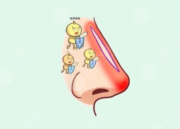 自體軟骨隆鼻的維持時(shí)間是多久