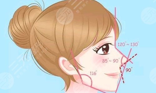 鼻部假體在10年之后會(huì)出現(xiàn)變形嗎