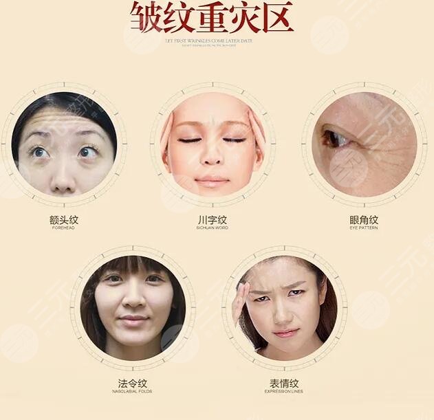 內(nèi)窺鏡拉皮手術(shù)降低風(fēng)險(xiǎn)嗎