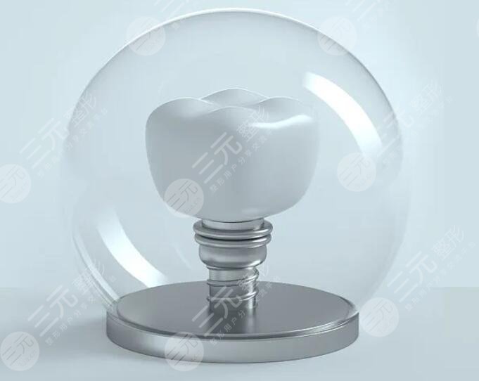 做種植牙的注意事項(xiàng)