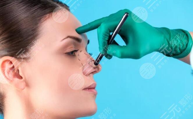 隆鼻假體壽命有多長(zhǎng)？假體隆鼻能夠維持多長(zhǎng)時(shí)間？假體隆鼻注意事項(xiàng)