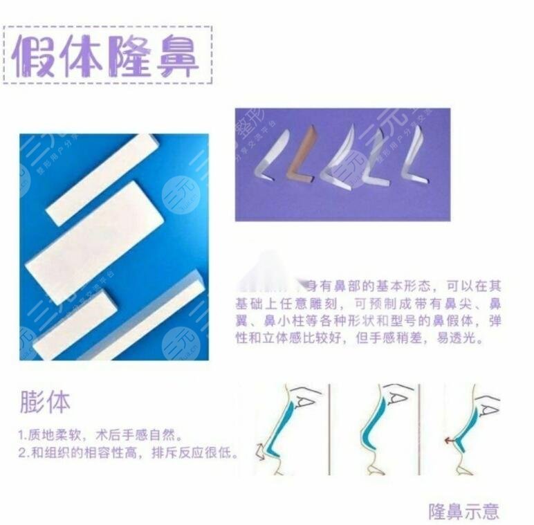 假體隆鼻的使用壽命是多久呢