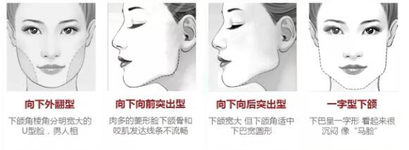 磨骨手術的原理