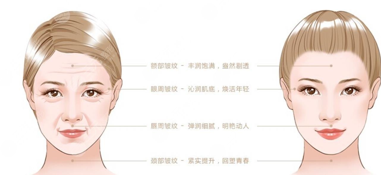 應用范圍的不同