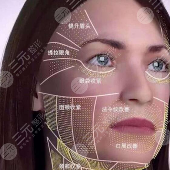 如何延長3D射頻美容手術(shù)的維持時(shí)間