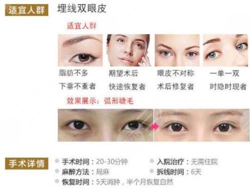 內(nèi)雙怎么變外雙的小竅門