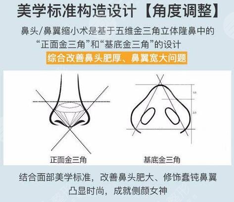鼻翼縮小手術(shù)費(fèi)用大概是多少錢(qián)，降低風(fēng)險(xiǎn)嗎？?jī)r(jià)格參考&術(shù)后護(hù)理指南！