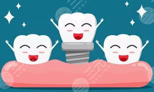 種植牙齒手術(shù)有什么優(yōu)點(diǎn)呢