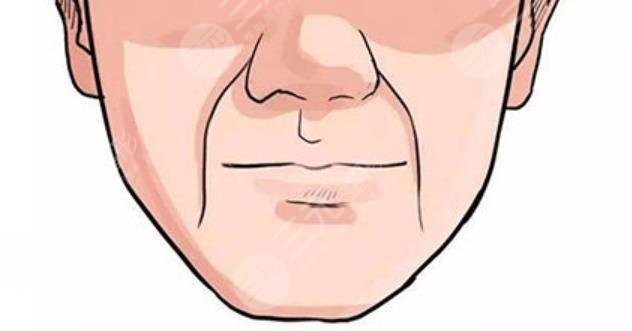 超聲提拉去法令紋果怎么樣