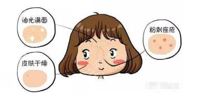 干貨分享|干皮vs油皮、油痘肌VS油敏肌，四者如何區(qū)分？怎么改良？