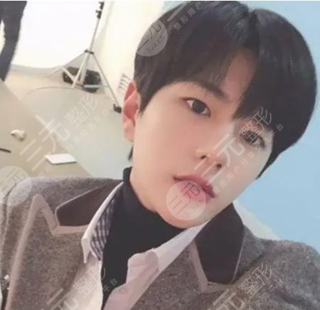 崔普閔整容實錘！00后韓團男愛豆整容失敗換了張臉！他動了那里？