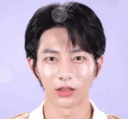 崔普閔整容盤點