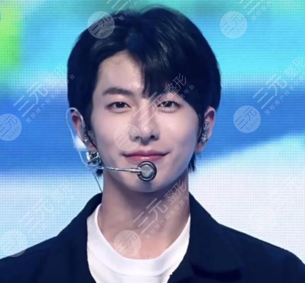 崔普閔整容盤點