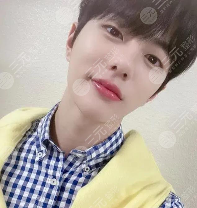 崔普閔整容盤點