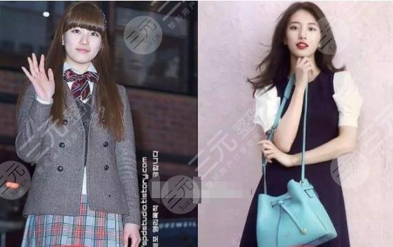 裴秀智微調(diào)整容參考標(biāo)準(zhǔn)！變美拿下李敏鎬，來(lái)看看她整了哪里！