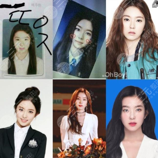 裴珠泫整容了嗎?