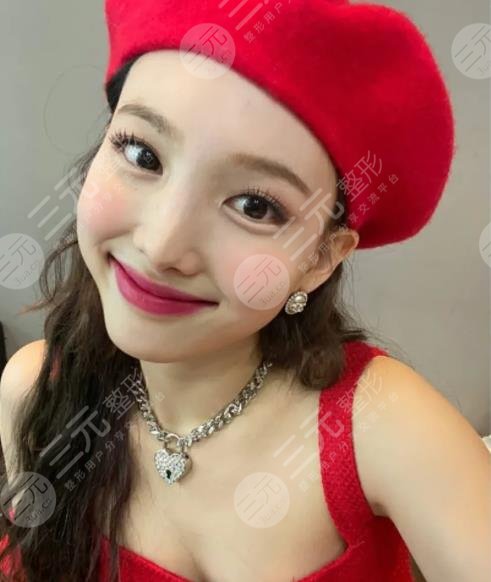 林娜璉整容了嗎?