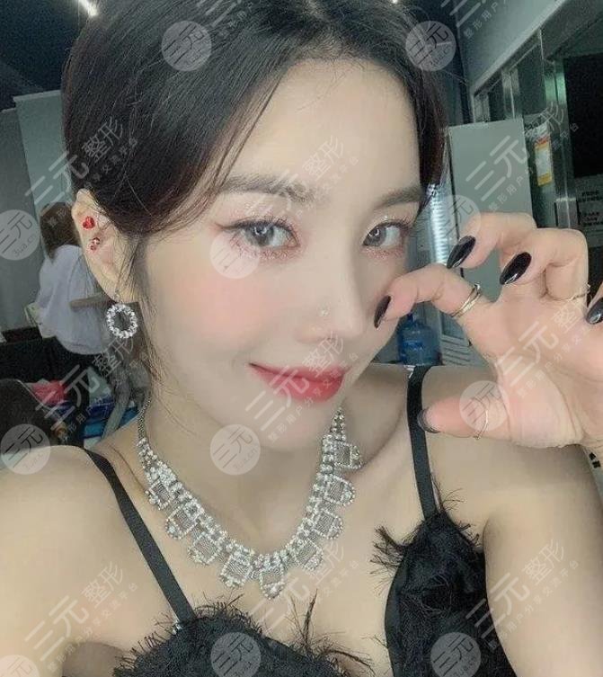 權(quán)恩妃整容了？solo近照公開神似裴珠泫Irene？她整了那些地方？