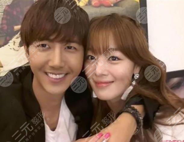 黃光熙整容歷史盤點(diǎn)!