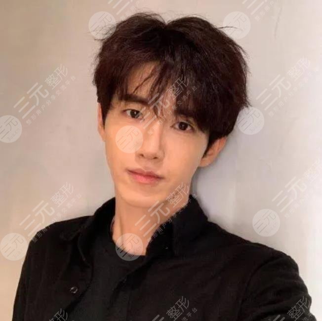 黃光熙整容失敗男愛豆近照曝光！他再次在大眾眼前“換頭”成功！