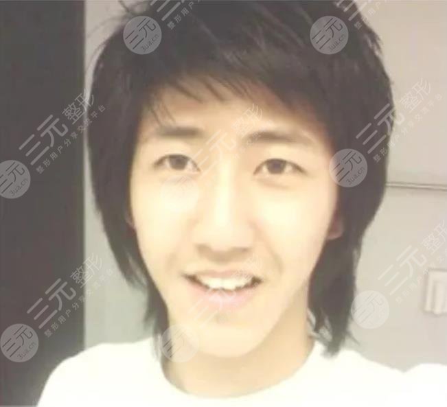 黃光熙整容歷史盤點(diǎn)!