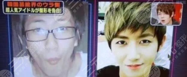 黃光熙整容歷史盤點(diǎn)!