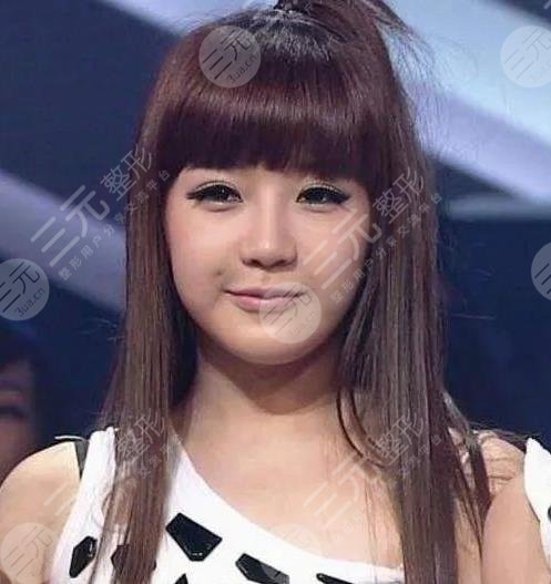 樸春變臉成“怪物”?她動(dòng)了哪些地方?