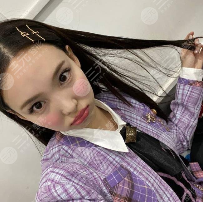 TWICE林娜璉顏值下降的原因有哪些?